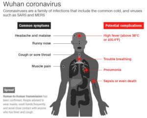 Symptome und Komplikationen des Wuhan-Coronavirus