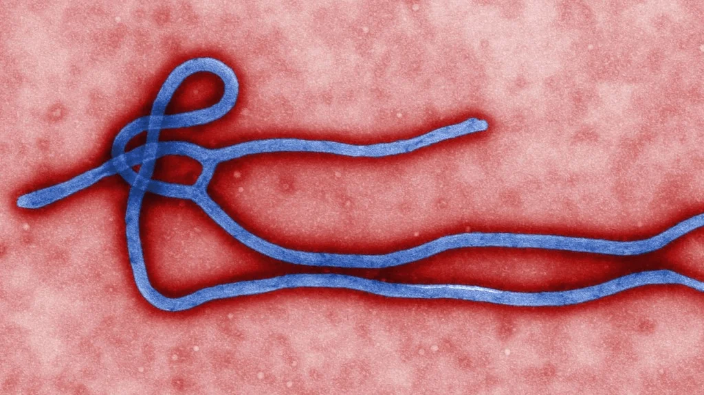 Come si Diffonde l"Ebola: La Tragedia di un Medico