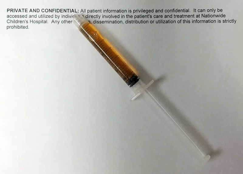 Global brist på gula feber-vaccin